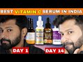Must Watch before Buying Vitamin C Serum for Skin Brightening | Shocking Results 😱😍 | Shadhik Azeez