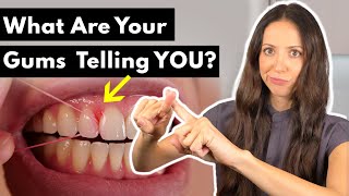 Why Do Gums HURT & BLEED After Flossing?