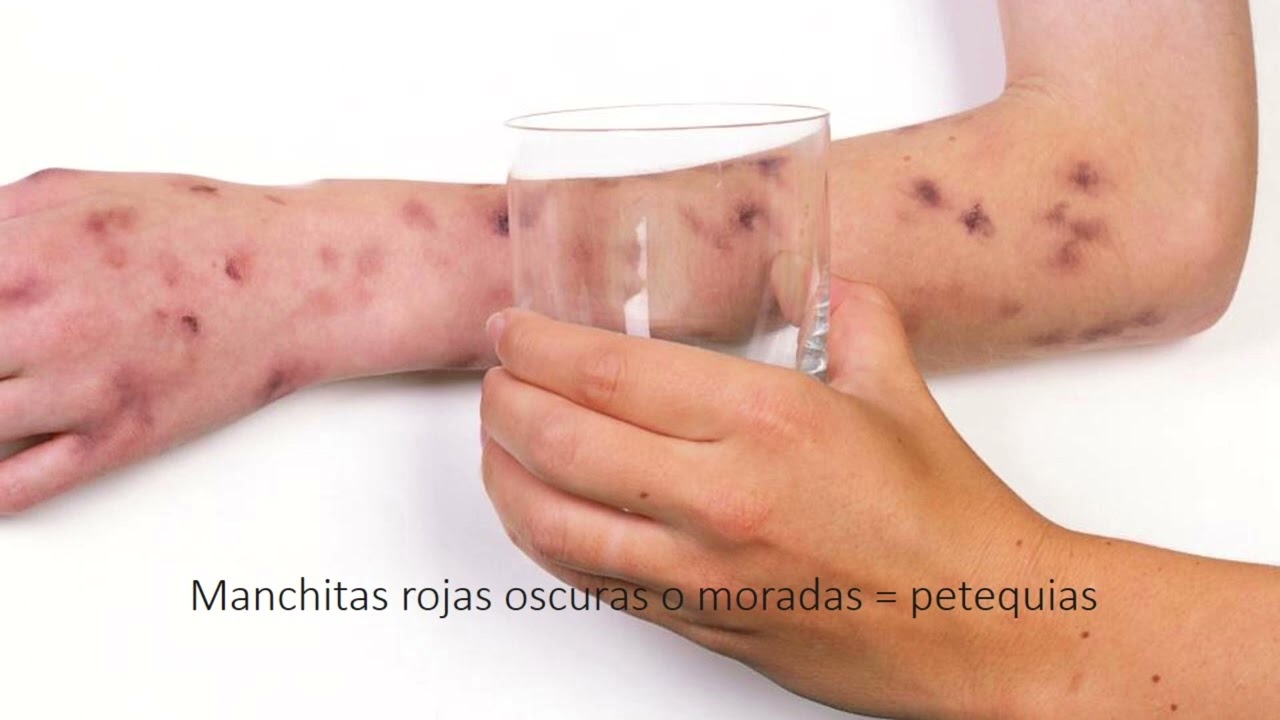 Juan Sánchez Caballero-2