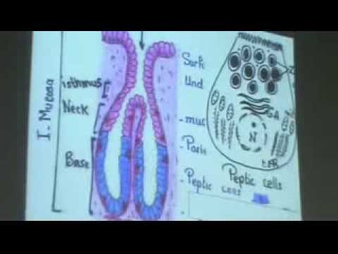 Dr Gihan Pylorus of Stomach 27-10-2013