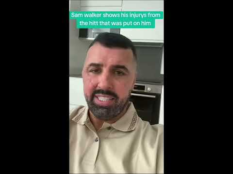 Sam Walker Shows Off His Injuries From The Attack