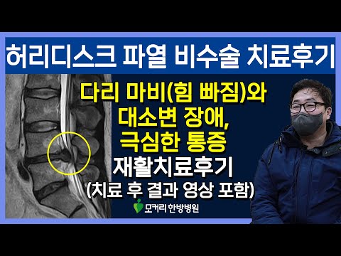 치료후기사진 입니다.