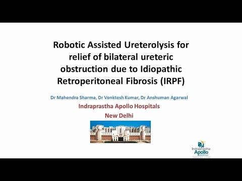 Robotic Assisted Ureterolysis for relief of bilateral ureteric obstruction due to IRPF