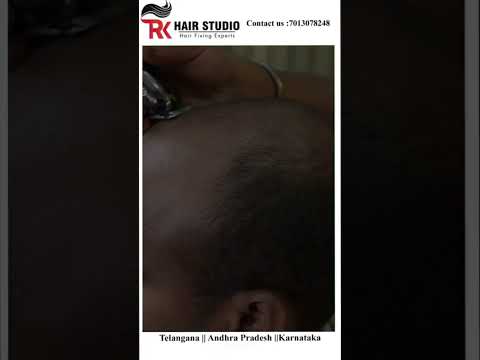 Hair patch transformation