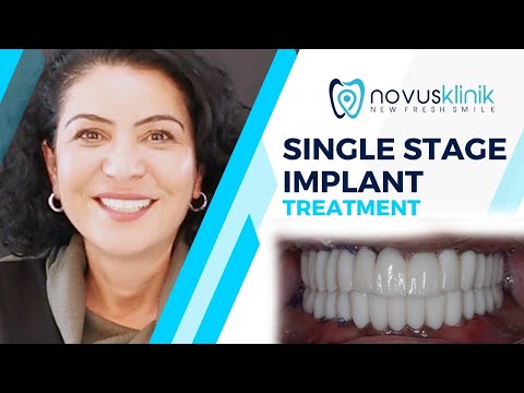 Logo of Transform Your Smile in Just 72 Hours – Single-Stage Dental Implants Explained in Istanbul, Turkey