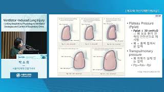 The 32th Asan Ventilator Workshop : Ventilator-Induced Lung Injury: Linking Respiratory Physiology to Ventilator Strategies and Control of Respiratory Drive 미리보기
