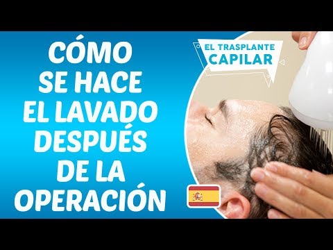El primer lavado después del trasplante capilar - Dr. Hamid AYDIN