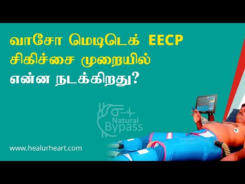 வாசோ மெடிடெக் EECP சிகிச்சை முறையில் என்ன நடக்கிறது?