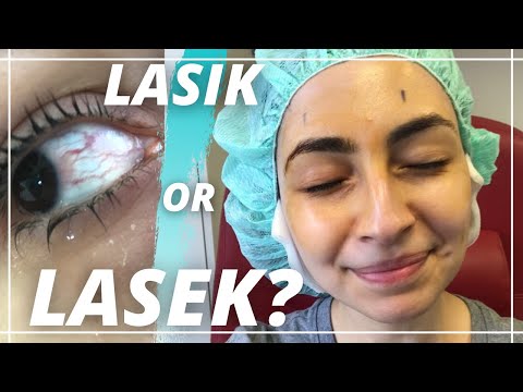 LASEK vs LASIK difference?? My Laser Eye Surgery Experience Day 1 - 2 year UPDATE VLOG!