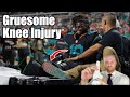Tyreek Hill Injury Update Tyreek Hill Knee Injury Explained