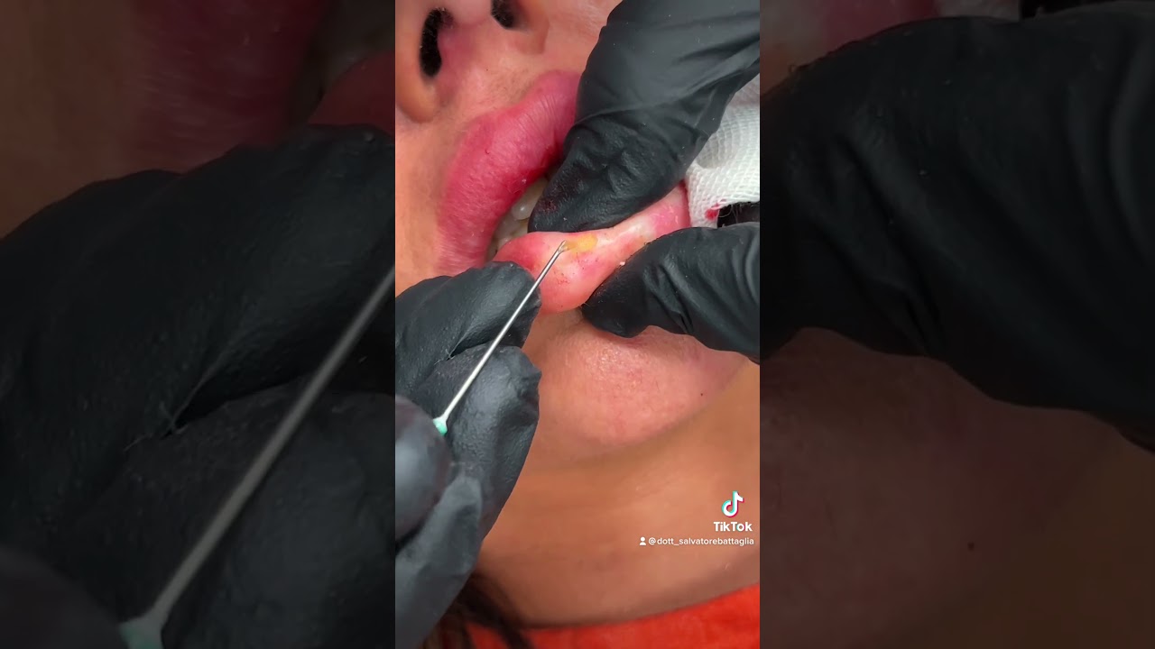 Salvatore Battaglia-17