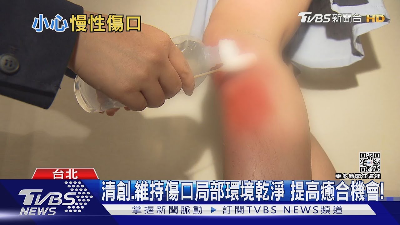 傷口潰瘍難癒合出現這幾種症狀 醫師警告:儘速就醫!