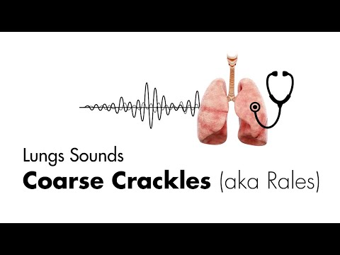 Coarse Crackles (Rales) - Lung Sounds - Medzcool