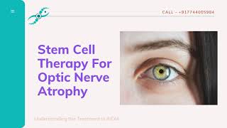 Stem Cell Therapy For Optic Nerve Atrophy in India | Fedorov Restoration Therapy in India | SCTCI