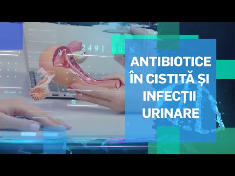 durere pe partea stângă a vezicii urinare tratamentul prostatitei cronice non-bacteriene