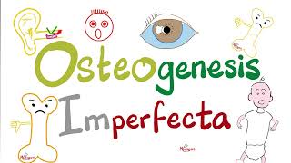 Osteogenesis Imperfecta (OI) - Brittle Bone Disease - Causes, Symptoms, Diagnosis, Treatment