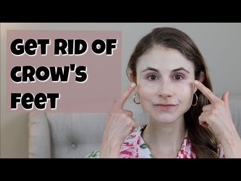 HOW TO GET RID OF CROW'S FEET| DR DRAY