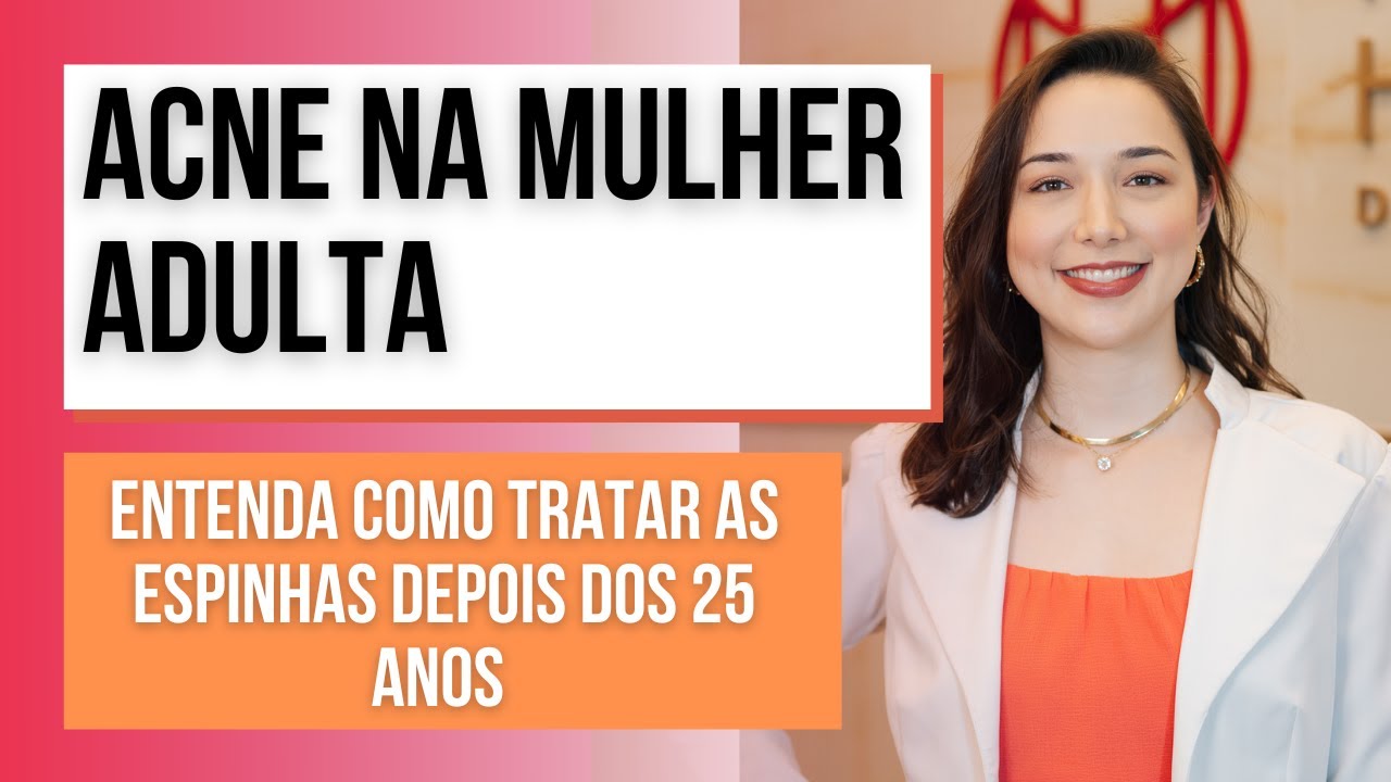 ACNE na mulher Adulta: Entenda como tratar cravos e espinhas depois dos 25 anos| Dra. Marina