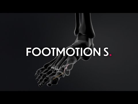 Footmotion S - Foot screws