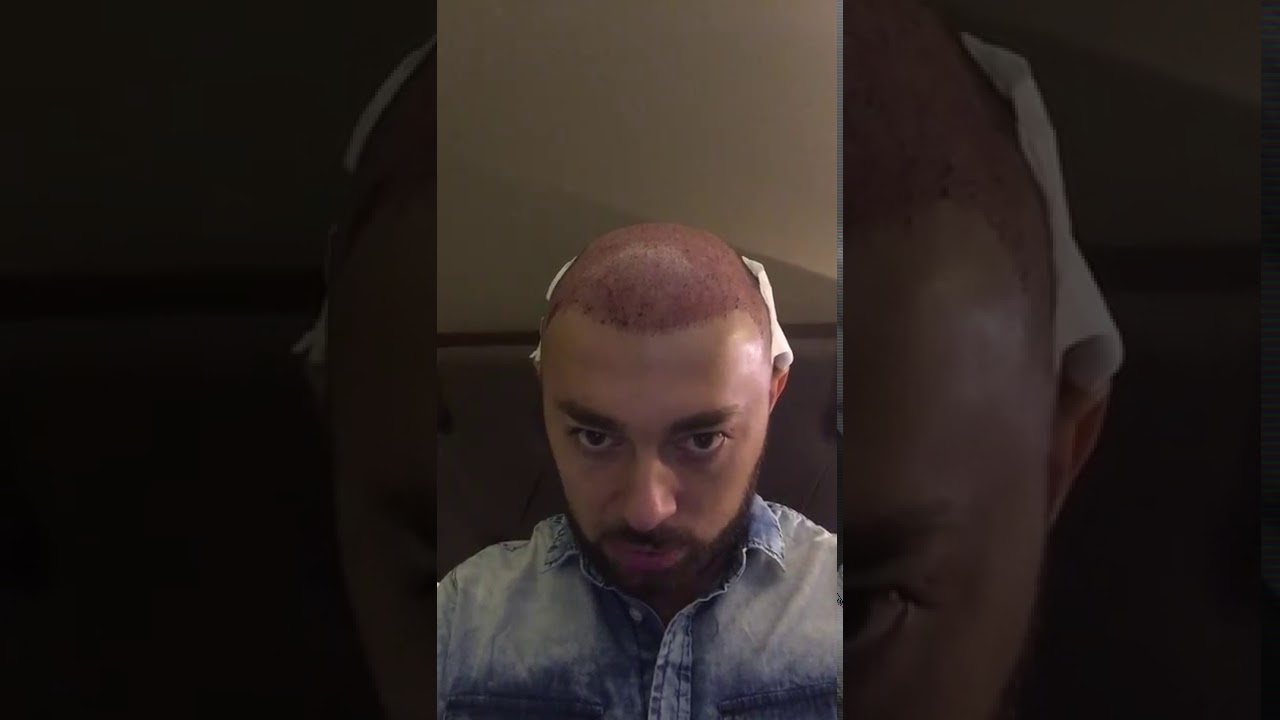 img-video