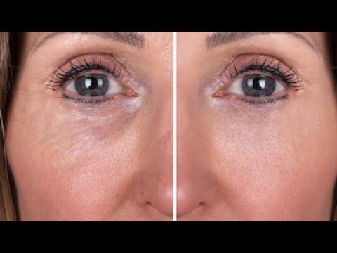 OVO JE TRADICIONALNI RUSKI RECEPT KOJI ĆE VAM ZATEGNUTI KOŽU LICA!