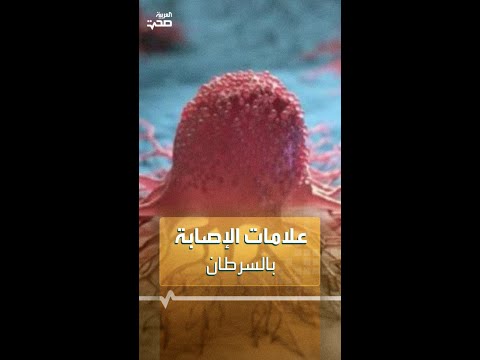 علامات الإصابة بالسرطان