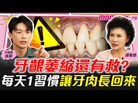 牙齦萎縮還有救? 每天1習慣讓牙肉長回來 ft. 炫晨 譚敦慈【 小宇宙大爆發 】