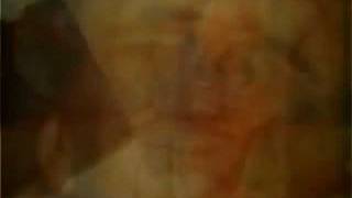 Eric Copeland - Brain Dead