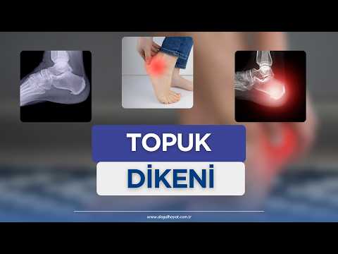 TOPUK DİKENİ