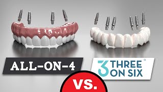 All-on-4 VERSUS 3 on 6