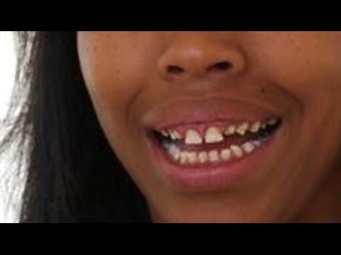 Drs’ Exclusive: Hospital Proposal Goes Viral; Help! I Have Tiny Teeth; Woman Fights Off Attacker