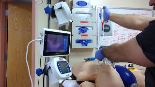 Ambu Ascope used to scope out the trachea and carina. Biggest mistake realized.