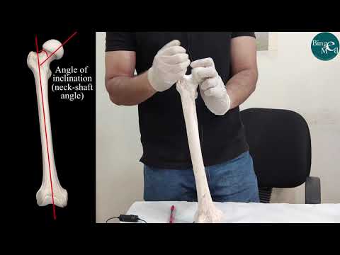 Femur angles
