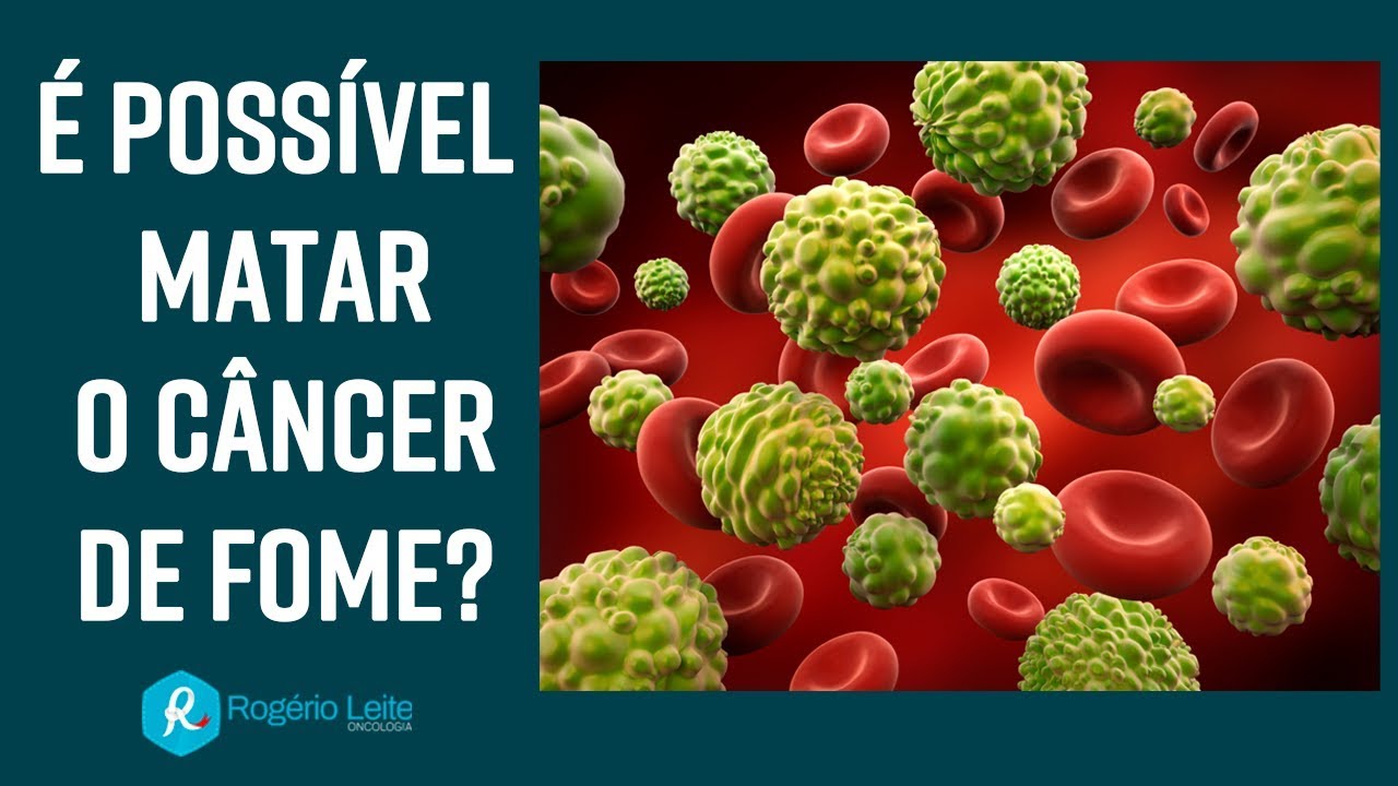É possível matar o câncer de fome?  [077] Dr. Rogério Leite