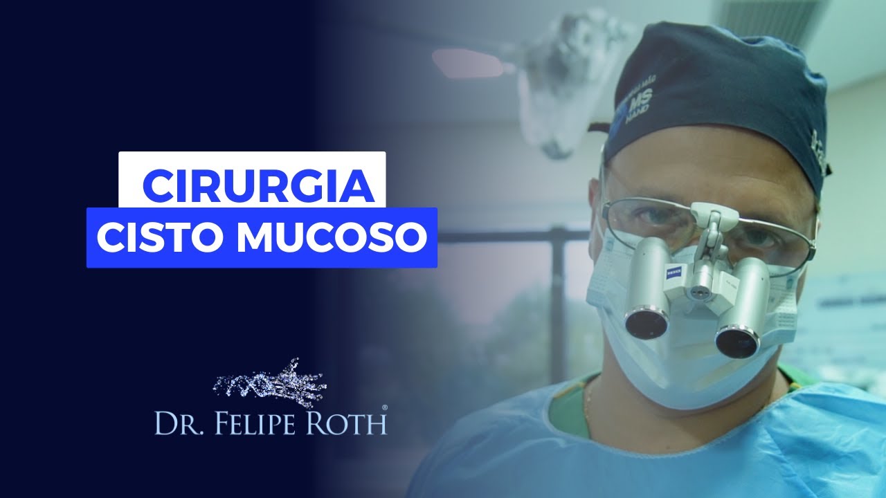 Dr. Felipe Roth I Cisto Mucoso