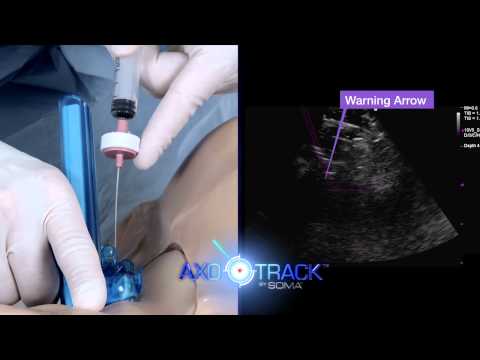AxoTrack needle visualization technology training video