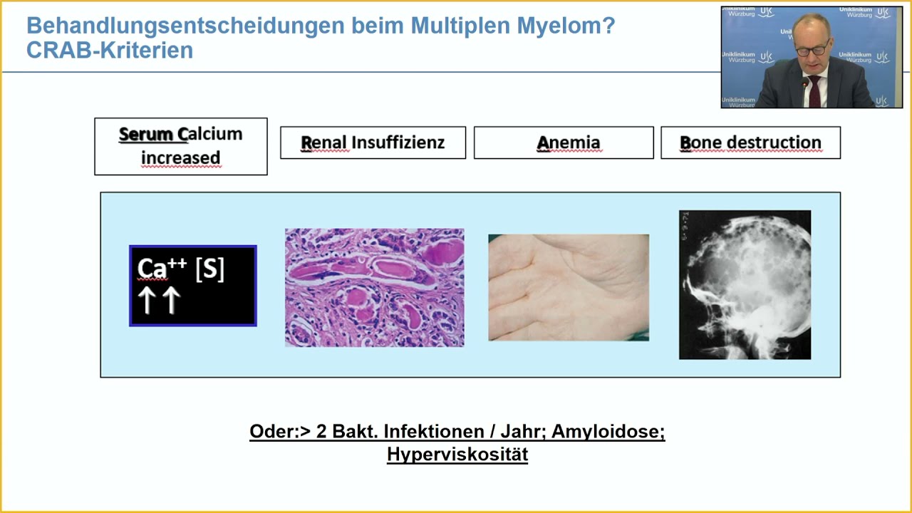 Neue Therapiemöglichkeiten beim Multiplen Myelom 