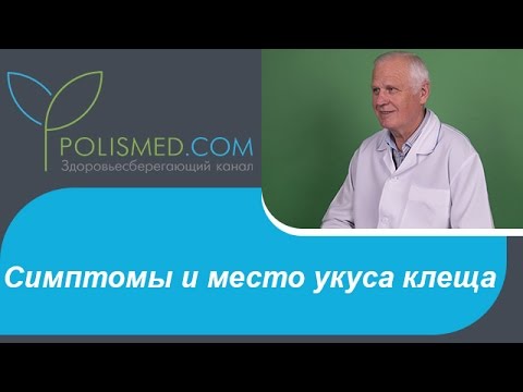 Сидение при артрозе тазобедренного сустава Упражнения при болях в пояснице в острый период