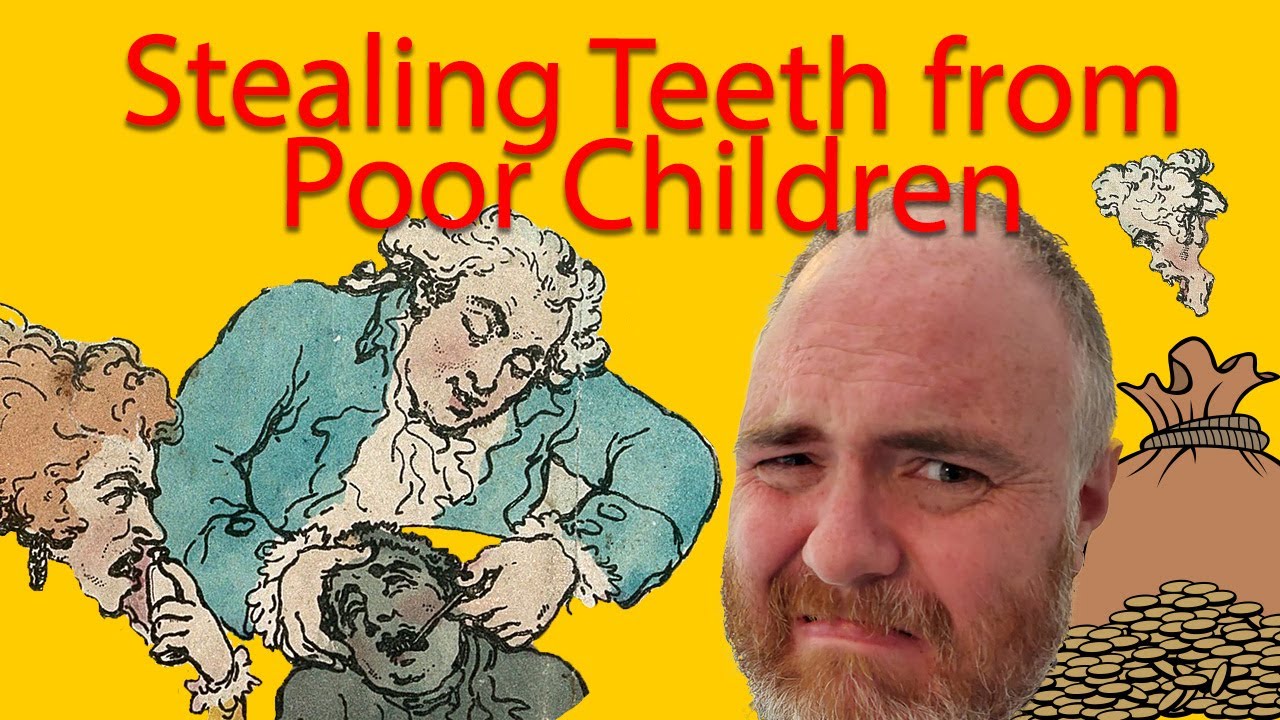4: Stealing teeth from poor children in the Eighteenth Century