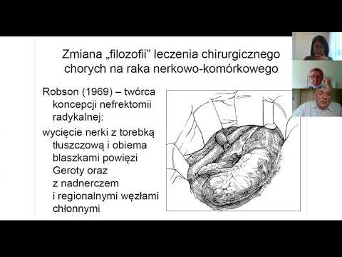 Rak nerki dr Andrzej Antczak dr Piotr Tomczak