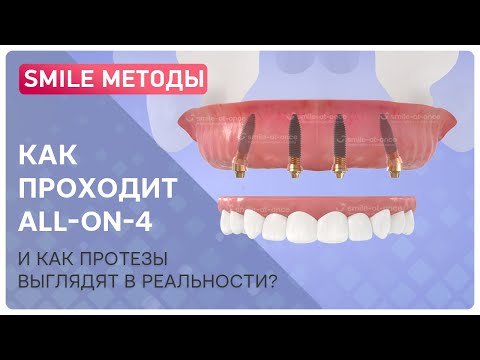 Восстановление функции жевания происходит после заживления