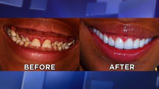 Ovarian Cancer Risk Passed on from Father; Myth or Reality; A Complete Mouth Makeover; The Gross …