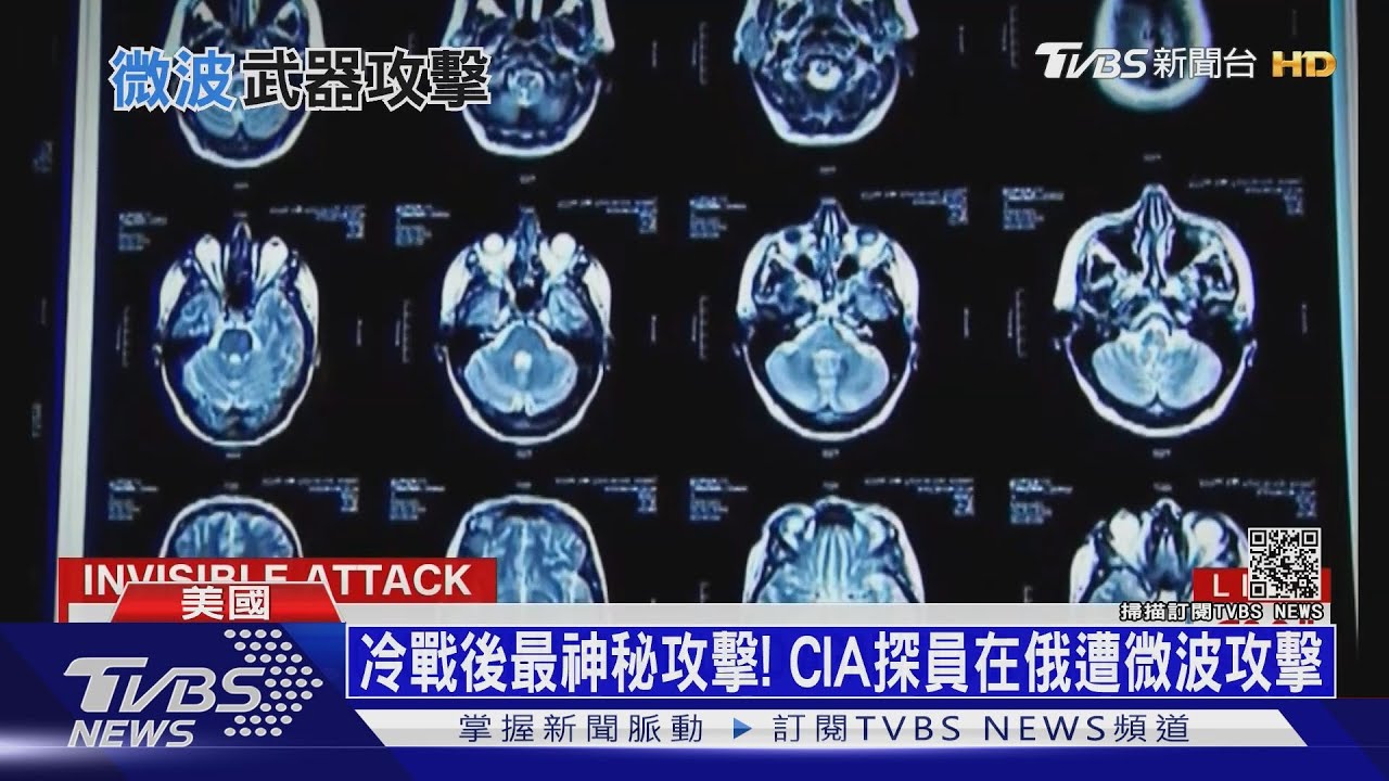 「比挨子彈還痛苦!」 美CIA探員憶「遭微波攻擊」