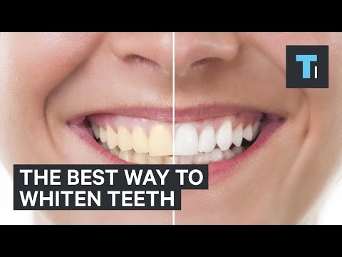 YouTube video about: Does teeth cleaning whiten?