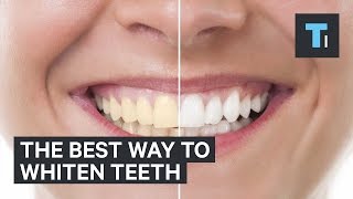 The best way to whiten teeth