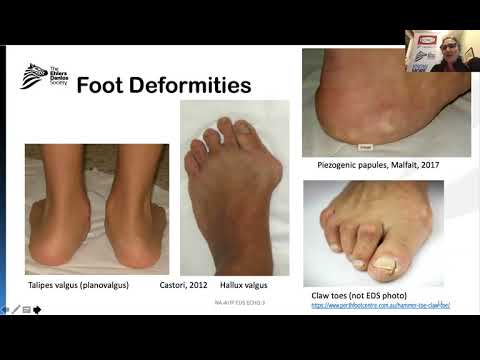EDS ECHO Allied Health Professionals North America (P1), Session 3
