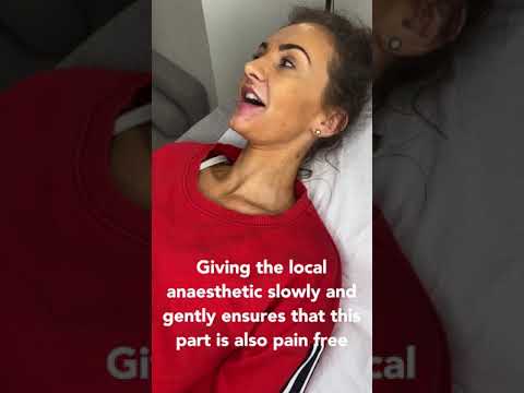 Numbing lips completely with LA before a lip filler treatment