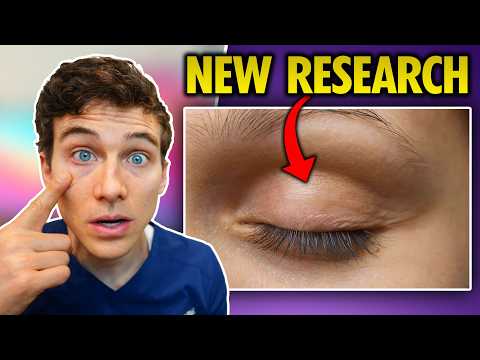 How to do Dry Eye Blinking Exercises (New Research)