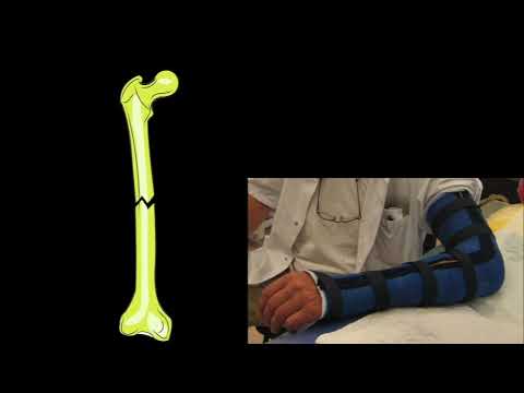 Meester Daan - Het skelet