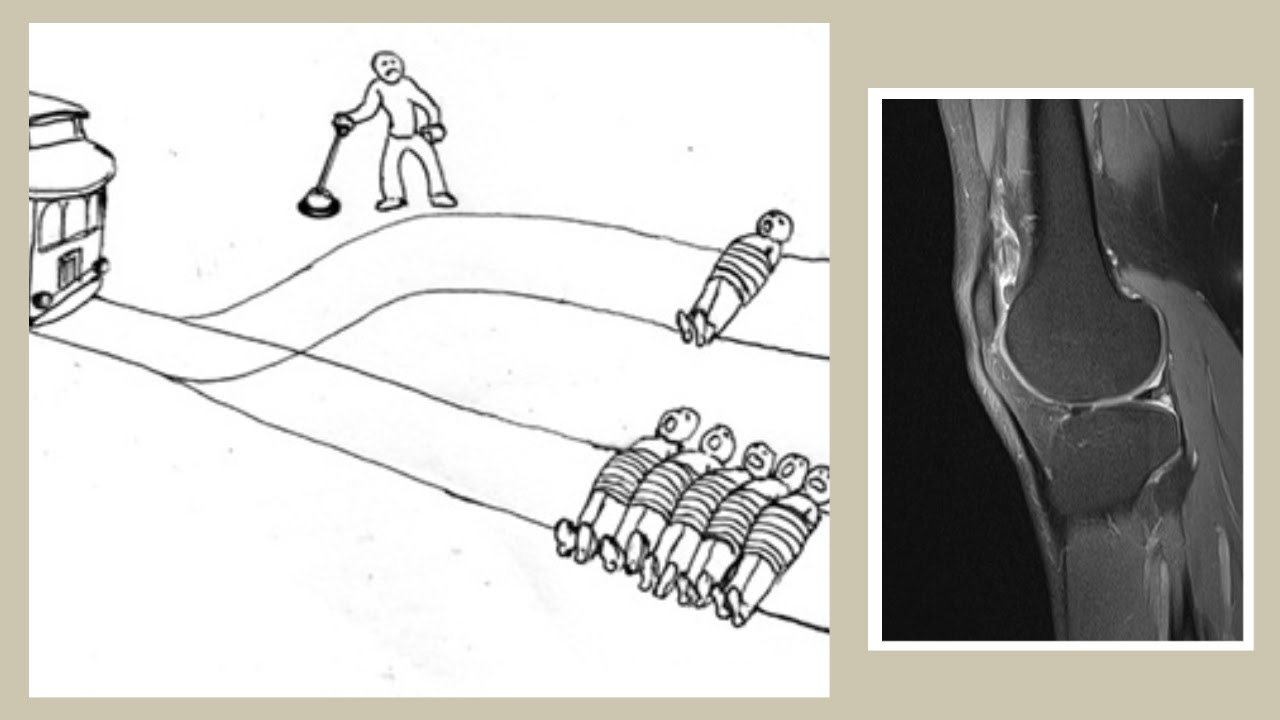 Trolley Problem Analysis: Knee Surgery (see link in description)